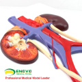 UROLOGY02(12422) Human Urogenital System, On Board, Anatomy Models > Medical Anatomy Urinary Models